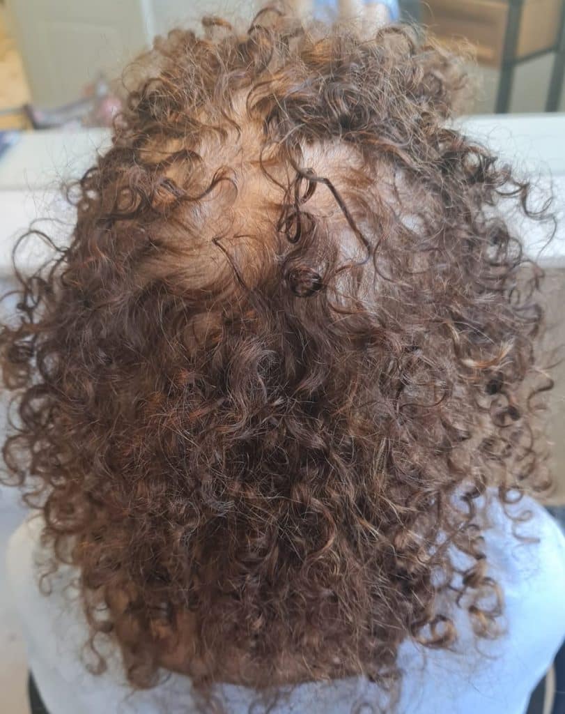 שיער בהתקרחות של גבר